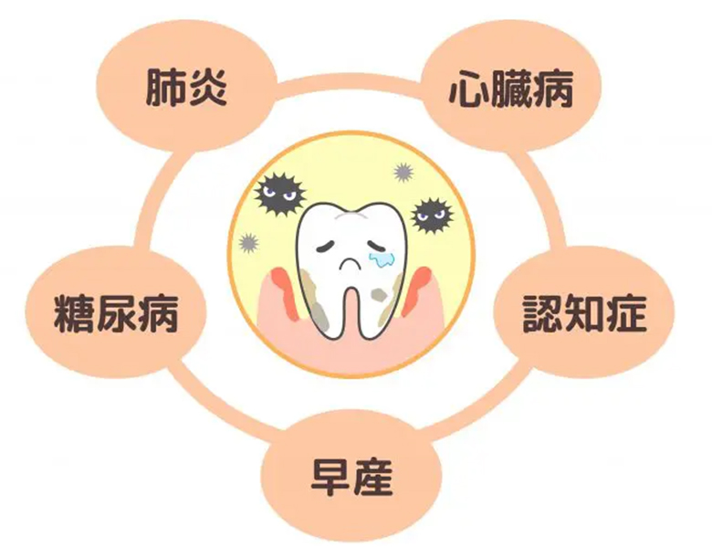 各務原市(鵜沼)の歯医者、医療法人正法閣 都クリニックの予防歯科