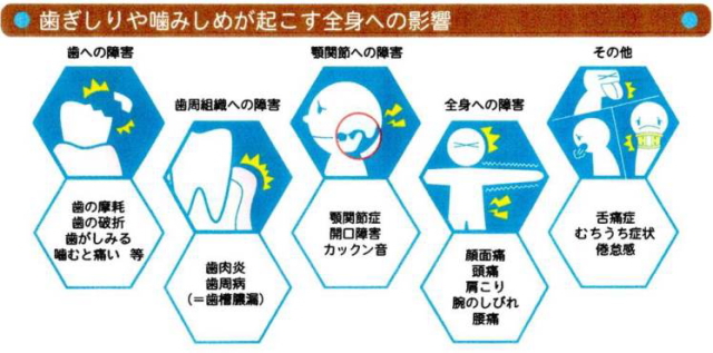 歯軋りや噛みしめが起こす全身への影響