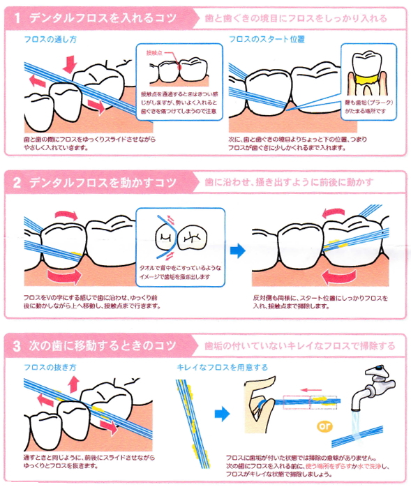 デンタルフロスの使い方