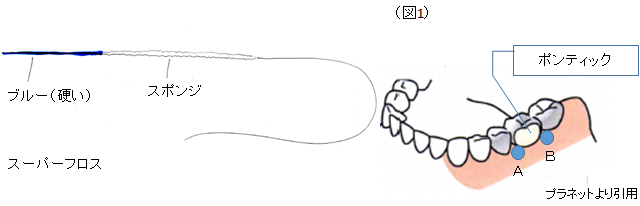 スーパーフロスの使い方