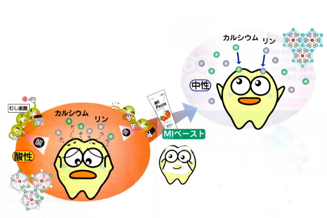 MIペーストに含まれるCPP-ACP